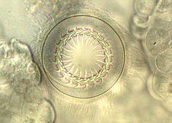 病名：纤毛虫病